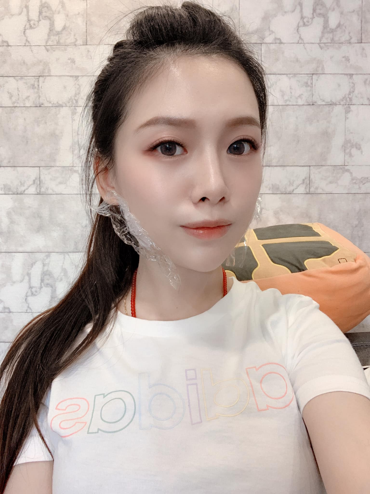 【肉毒桿菌】星和診所（新竹市）- 黃伊寧醫師-來星和矯正我的大小臉， 慣性用同一邊咬東西導致咀嚼肌一大一小！ ！！！～-曾琬婷
